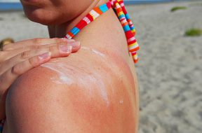 A woman applies sunblock at the beach