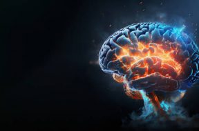 Brain on fire, exploding brain, degenerative cognitive disease concept like Parkinson's, Alzheimer's, dementia, MS (multiple sclerosis), brain power treatment 3d rendering